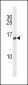 CALCA/CT Antibody (C-term)